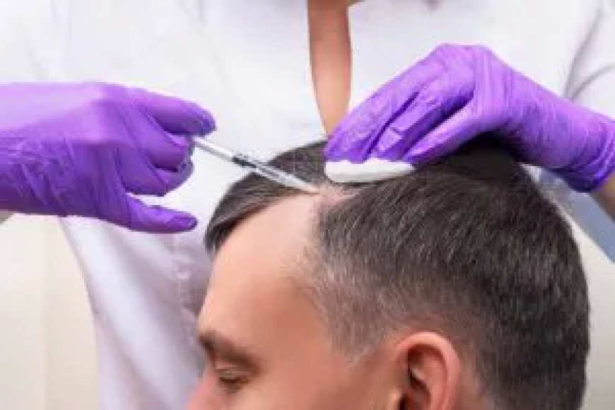 "Regain Your Confidence: Leading Hair Loss Clinics in London"