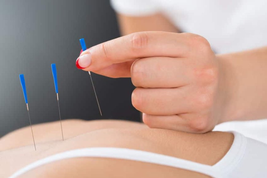 Comprehensive Guide to Acupuncture for Pain Relief in Orange County