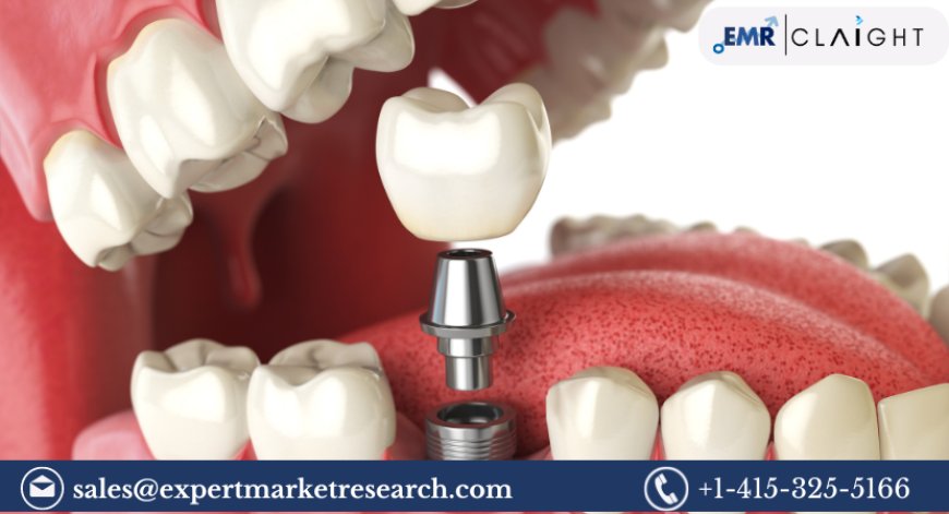 Global Dental Implants Market Size, Share, Trends, Growth, Analysis, Report and Forecast 2024-2032