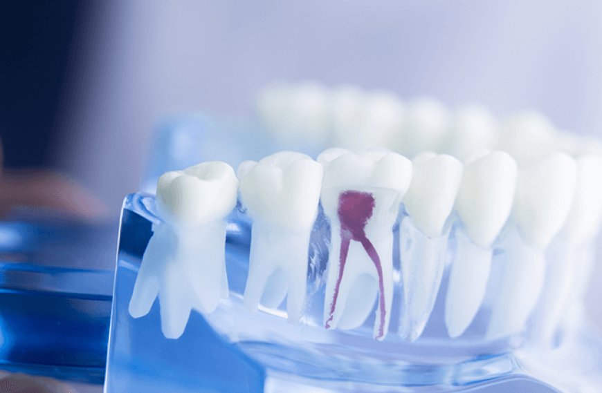 A Second Chance for Your Tooth: The Power of Root Canal Treatment