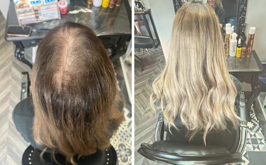 Is Your Hair Thinning? Here’s the Least Damaging Hair Extensions for Thin Hair