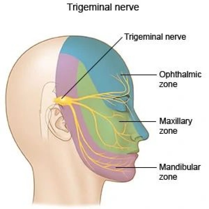 What is the Main Cause of Trigeminal Neuralgia?