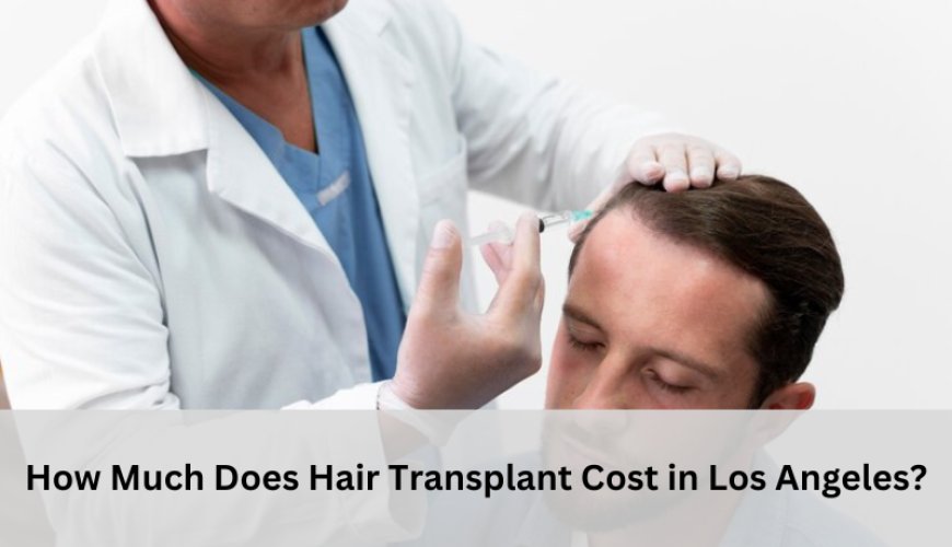 How Much Does Hair Transplant Cost in Los Angeles?