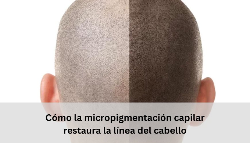 Cómo la micropigmentación capilar restaura la línea del cabello