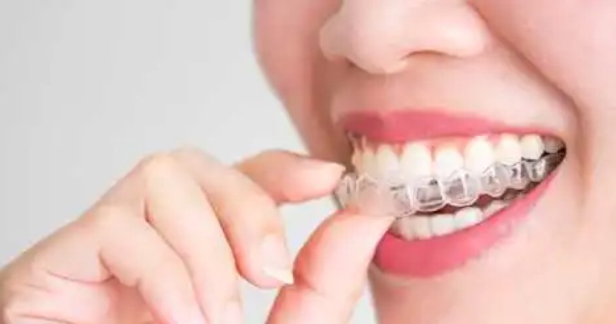 Braces in Mississauga: A Comprehensive Guide to Achieving a Beautiful Smile