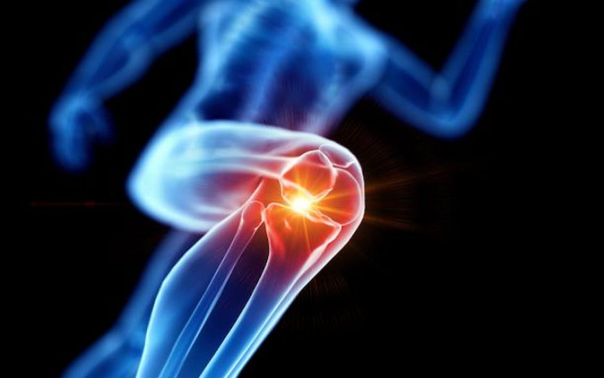 Best Exercises for Strengthening Knees and Preventing Pain