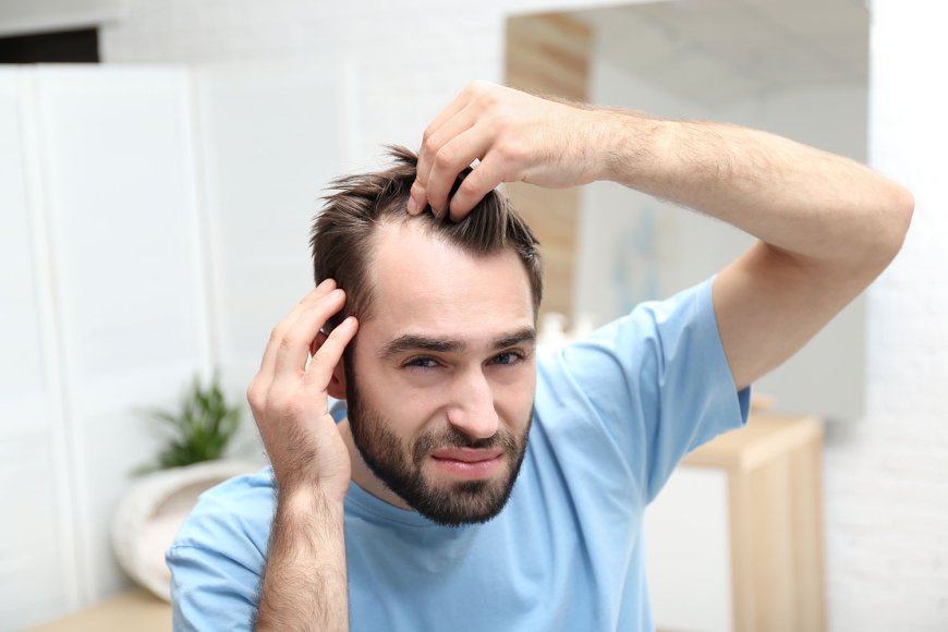 Achieve Fuller Hair: Benefits of Hair Transplant in Islamabad