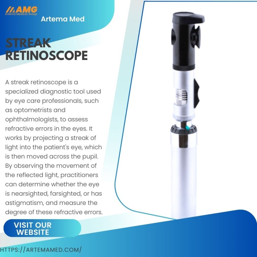 How the Steark Retinoscope Works: A Key Tool for Eye Examinations