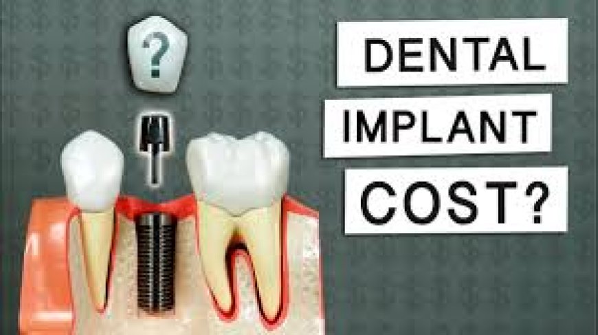 Cost of Dental Implants: Pricing and Options Explained