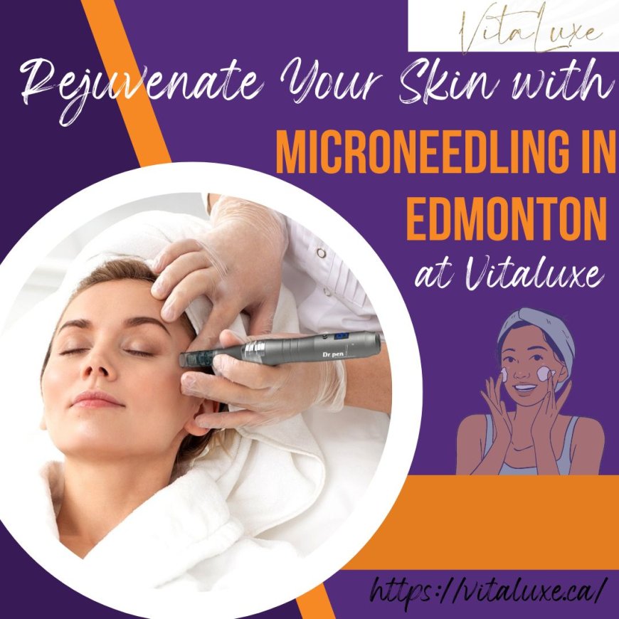 The Benefits of Microneedling: Rejuvenate Your Skin with Vitaluxe