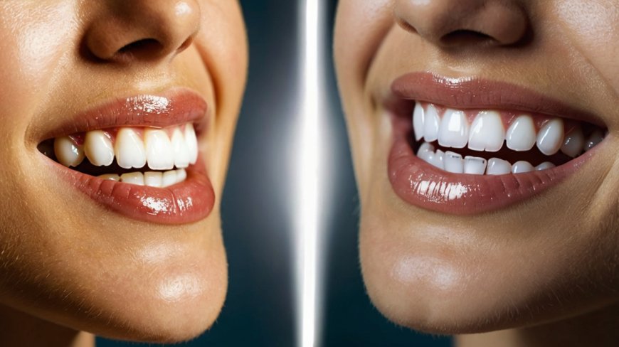 Does Invisalign Change Your Face Shape? Understanding the Impact