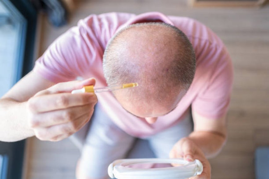 Effective Hair Loss Treatments: A Comprehensive Guide