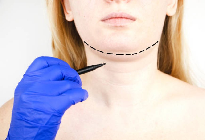 Double Chin Removal: Exploring Effective Treatments and Lifestyle Solutions