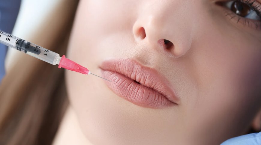 Impact of Russian Lip Fillers on Self Confidence Insights Best Aesthetic Clinic in Dubai