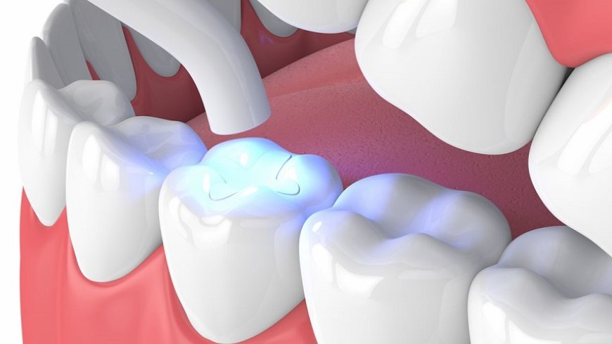 Can old amalgam fillings be replaced?