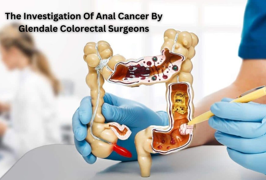 The Investigation Of Anal Cancer By Glendale Colorectal Surgeons