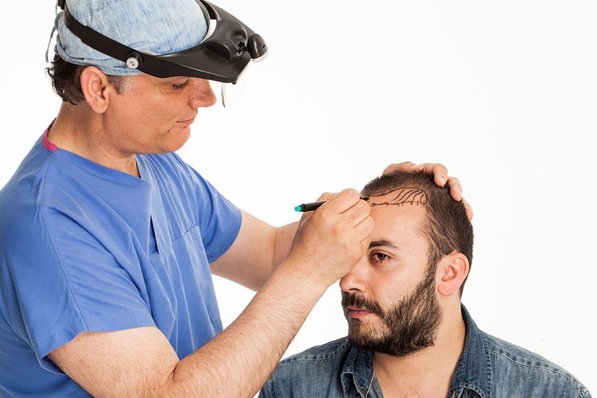 Comparing Non-Surgical and Surgical Hair Restoration Options