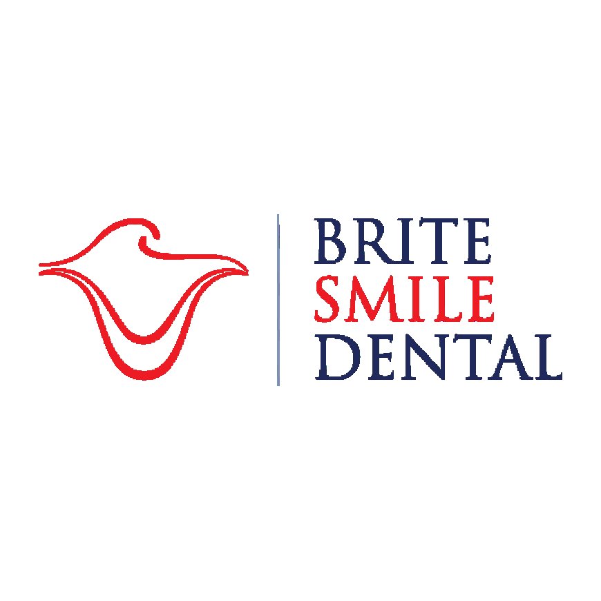 Transform Your Smile with Dental Veneers in San Diego | Brite Smile Dental