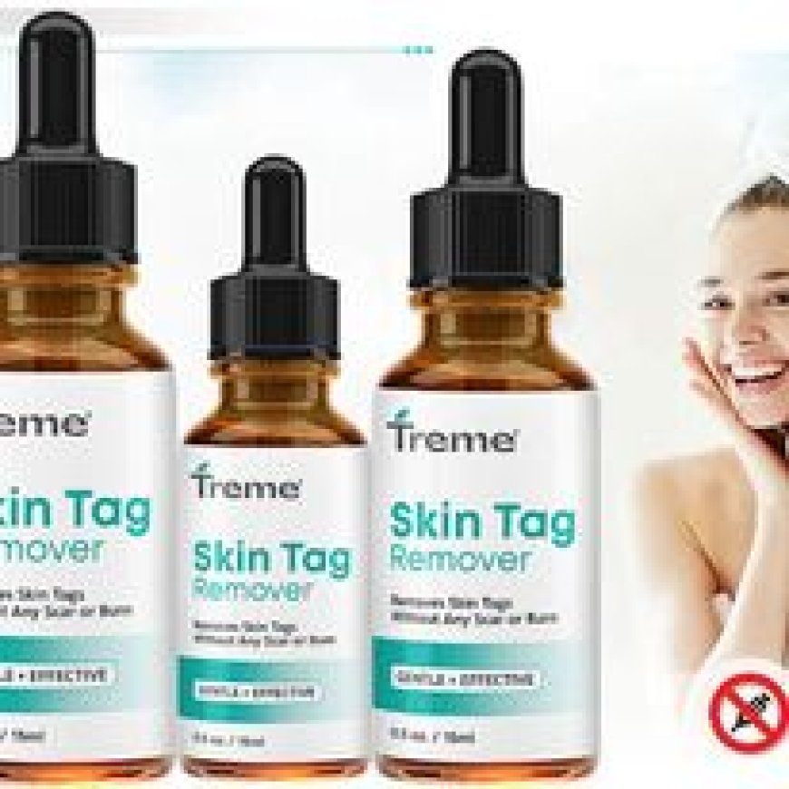 "Treme Skin Tag Remover: Honest Review"