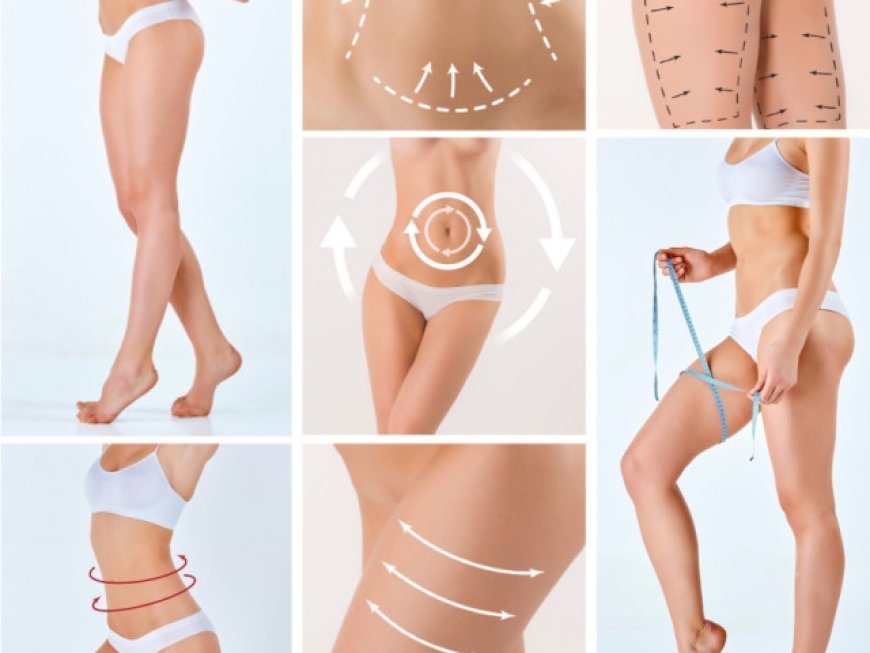 Discover the Art of Precision: Vaser Liposuction in Riyadh