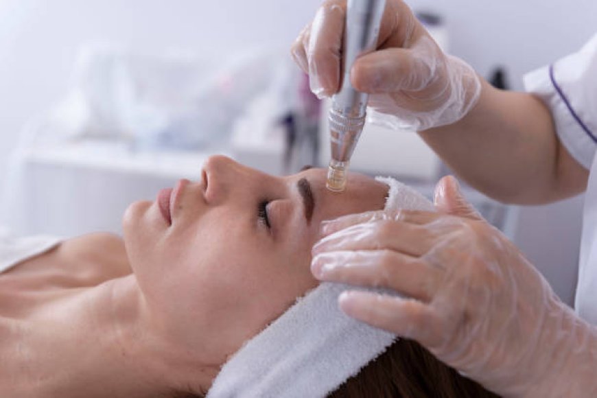 How Microneedling with PRP and Platelet Rich Plasma in New Jersey Can Restore Your Skin’s Youthful Glow