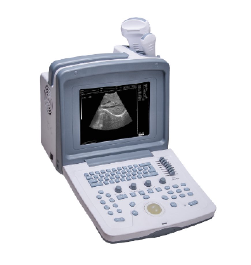 Fully Digital Ultrasound Machine Price in Lahore High-Precision Imaging Solutions