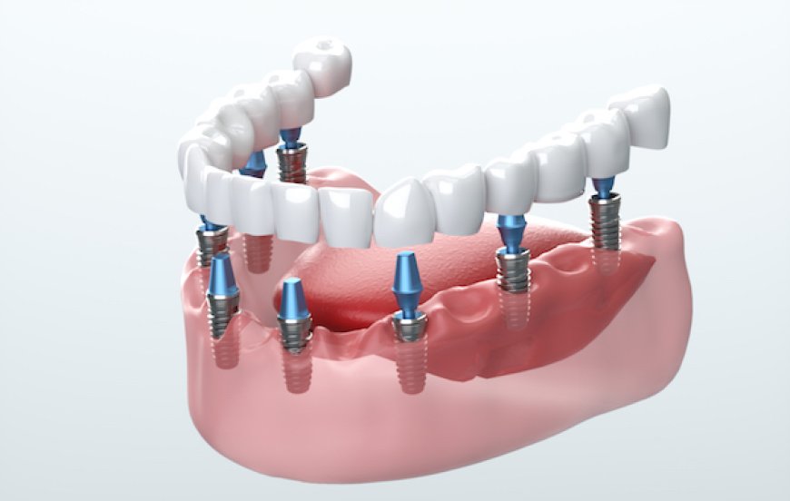 How Oral Sedation Dentistry Provides a 70% Faster Recovery for Nervous Patients