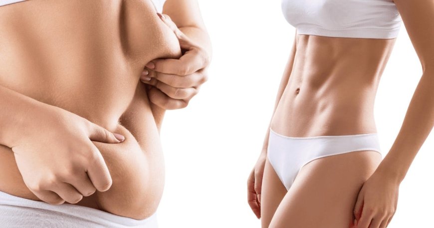 Transform Your Body with Cutting-Edge Sculpting Treatments in Redondo Beach, CA