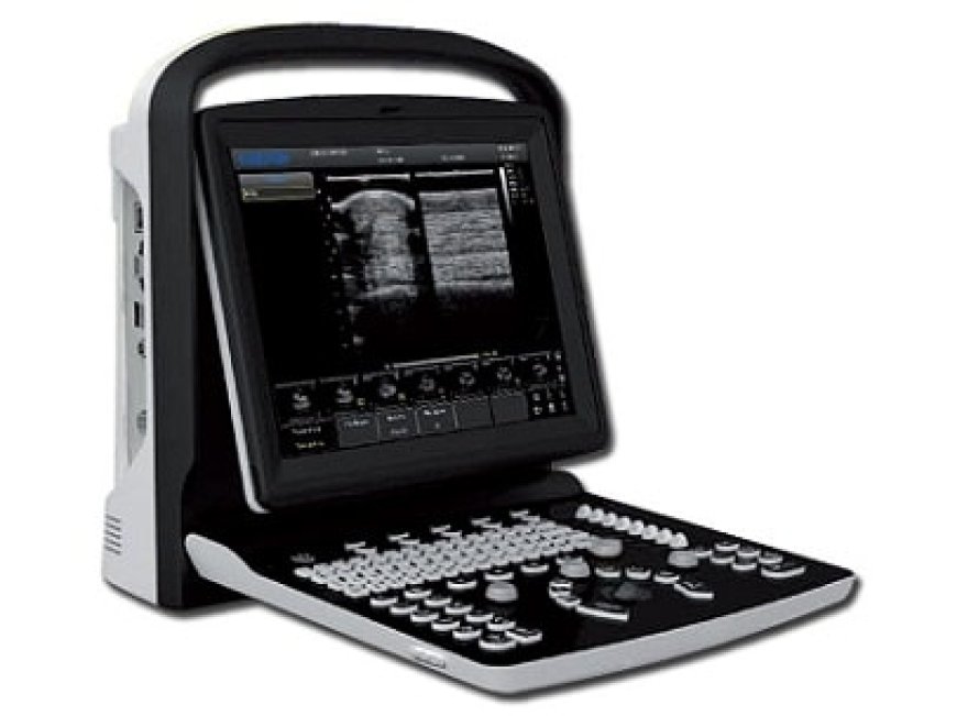 Laptop Ultrasound Machine Price in Pakistan