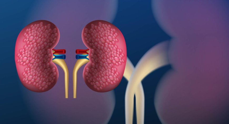 Navigating Kidney Transplants: Expertise and Facilities in Mumbai