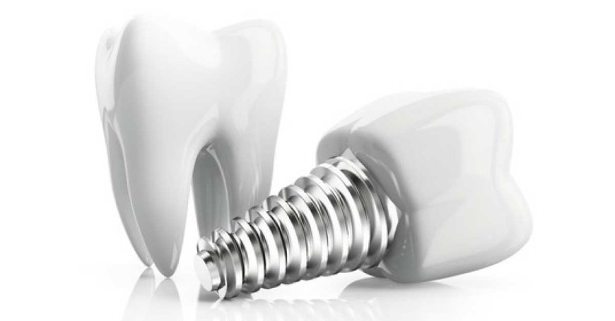 How can I make my dental implant heal faster?