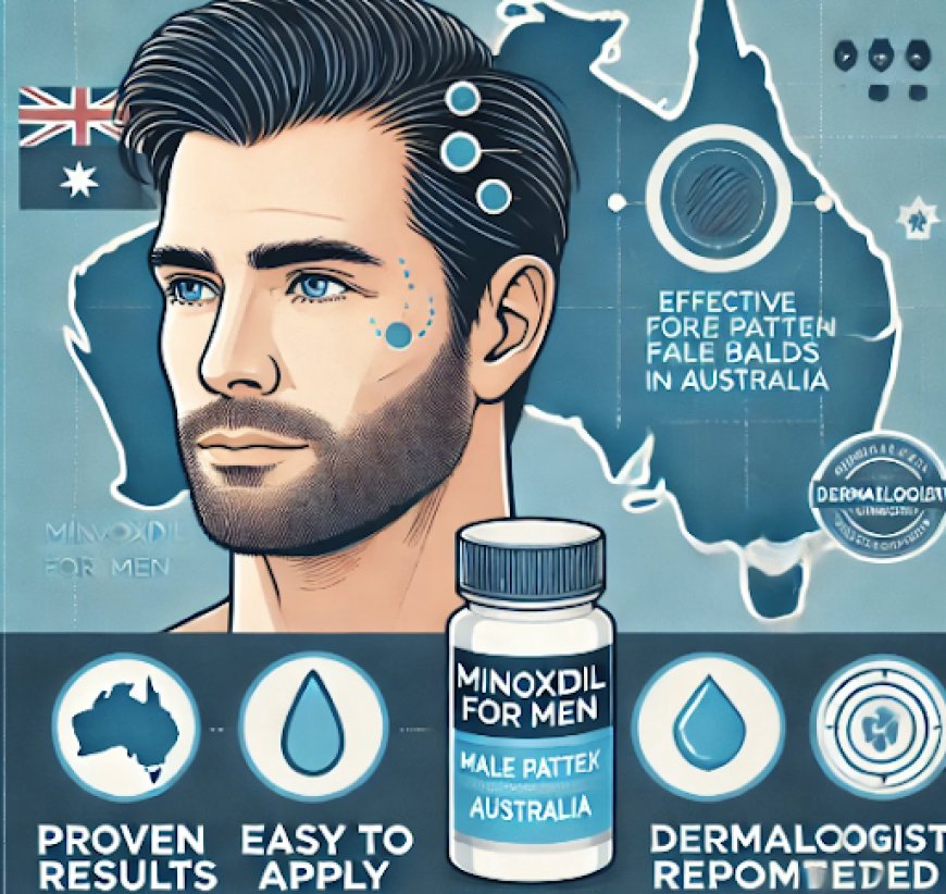 Minoxidil for Men: Effective Solution for Male Pattern Baldness in Australia