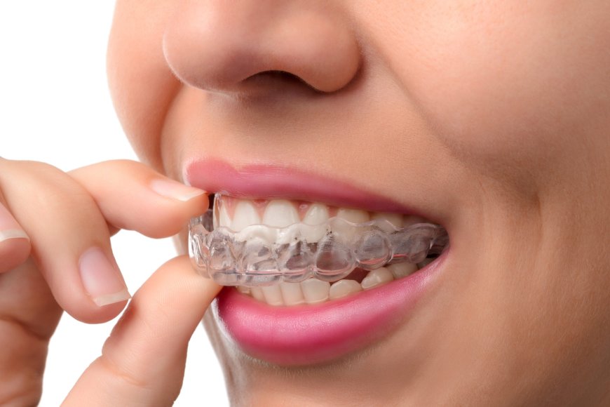 Is it hard to sleep in aligners?