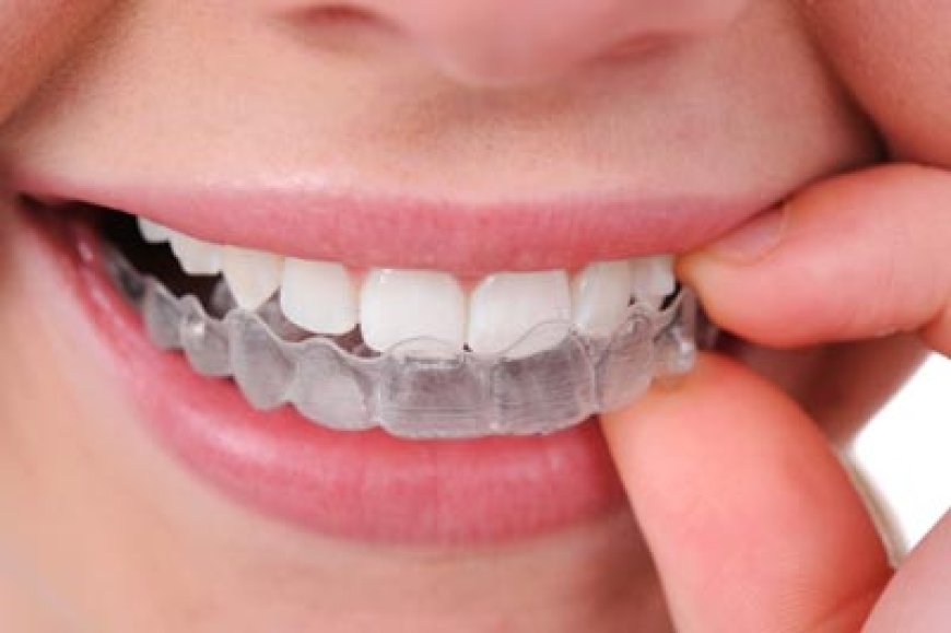 Best Invisible Braces in Indirapuram for a Perfect Smile