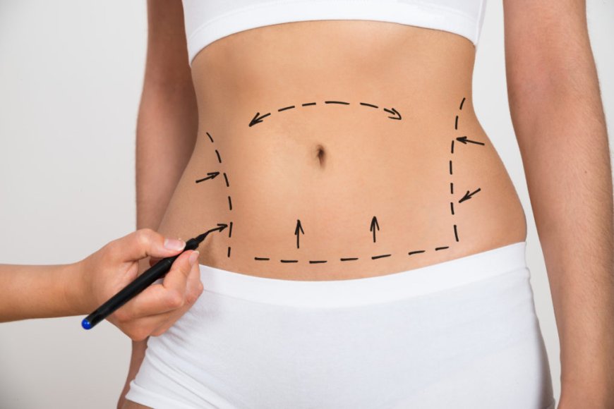 Transforming Lives The Impact of Full Body Liposuction in Dubai