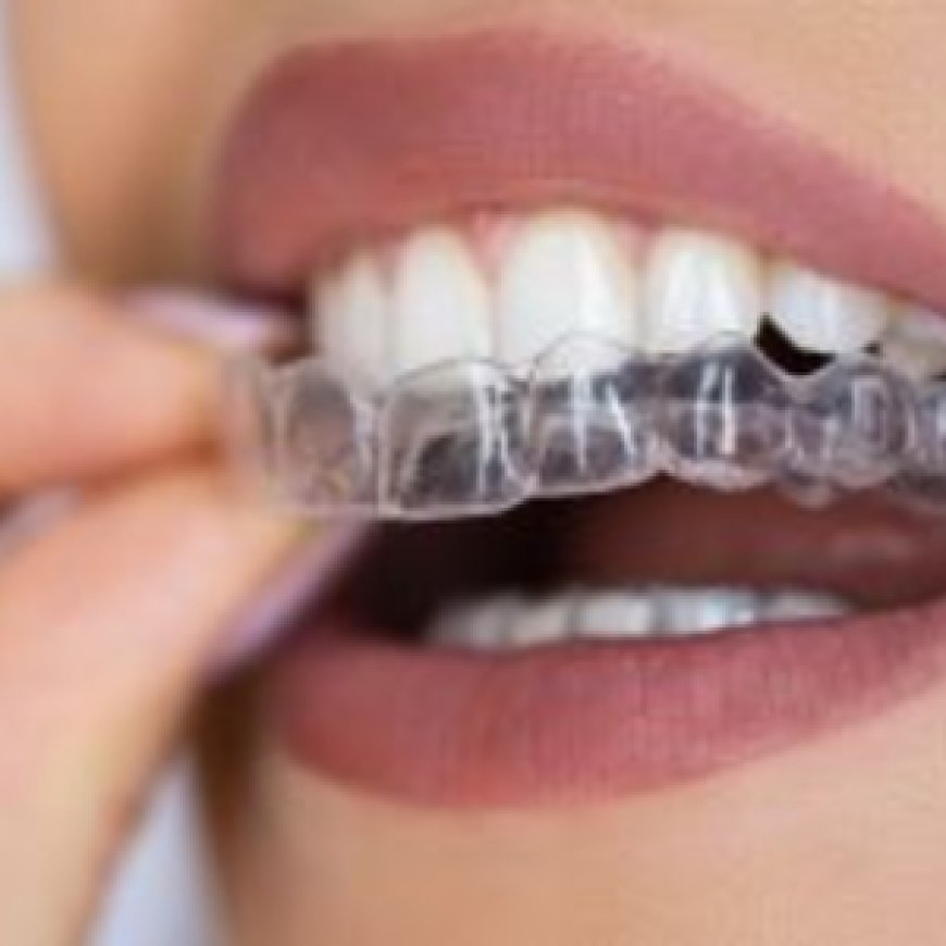 Finding the Best Invisalign Dentist Near Flint, MI for a Beautiful Smile