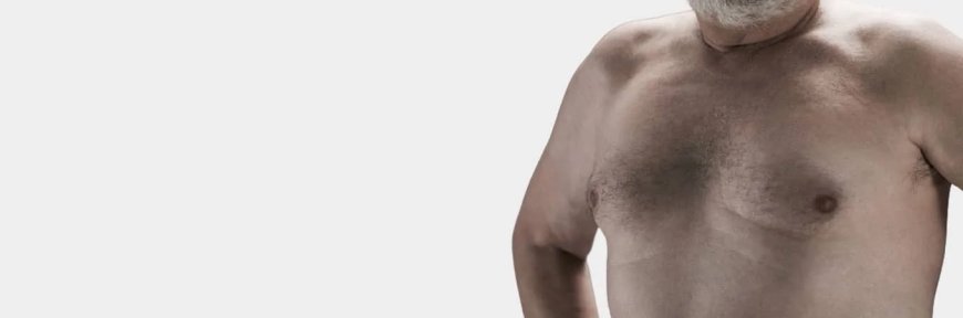 What is the Best Solution For Gynecomastia in Men?