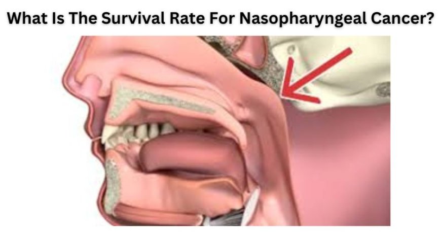 What Is The Survival Rate For Nasopharyngeal Cancer?