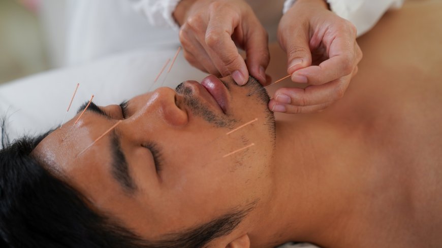 Rejuvenate with Facial Acupuncture in Philadelphia