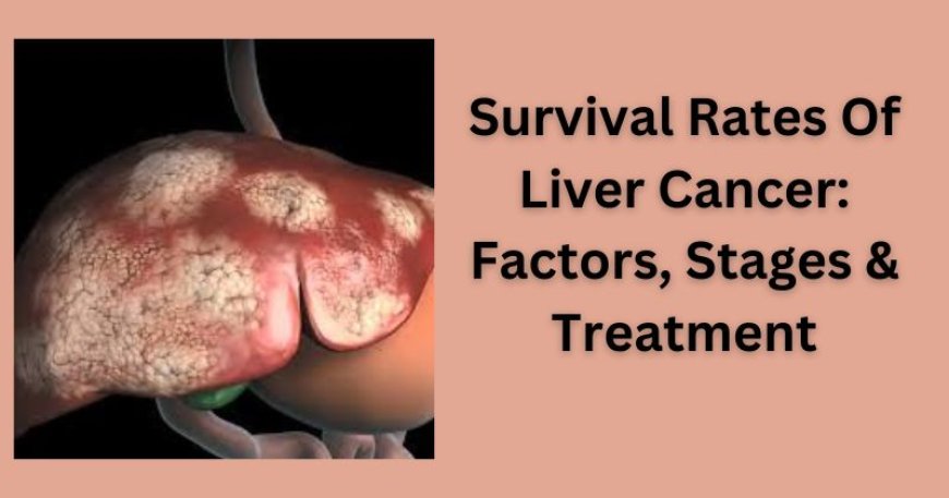 Survival Rates Of Liver Cancer: Factors, Stages & Treatment