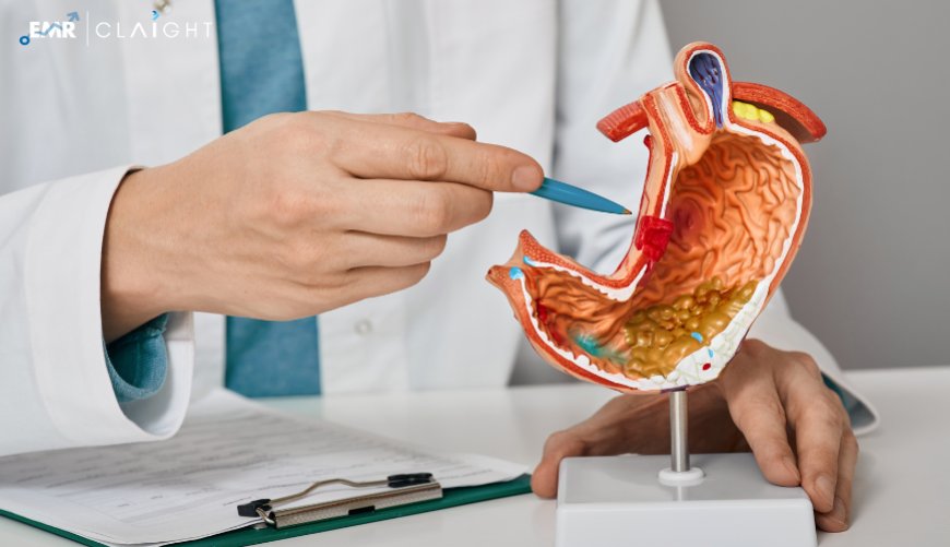 Gastroenterology Market – Global Forecast Report 2025–2034