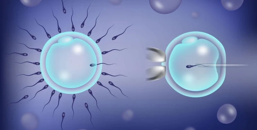 ICSI vs. IVF: Which Treatment Is Right for You?