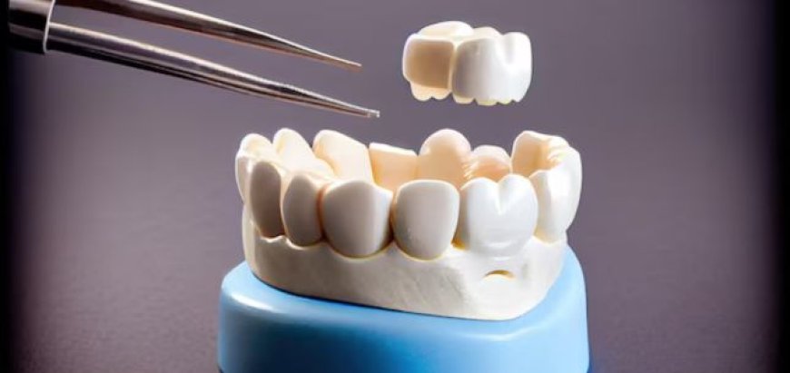Do You Need A Dental Crown? Signs, Benefits, And Costs
