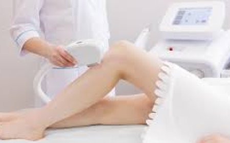 Does Sclerotherapy Cost Vary With Expected Treatment Outcomes?