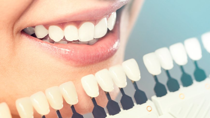 5 Beautiful Cosmetic Dentistry Treatments That Will Change Your Smile!