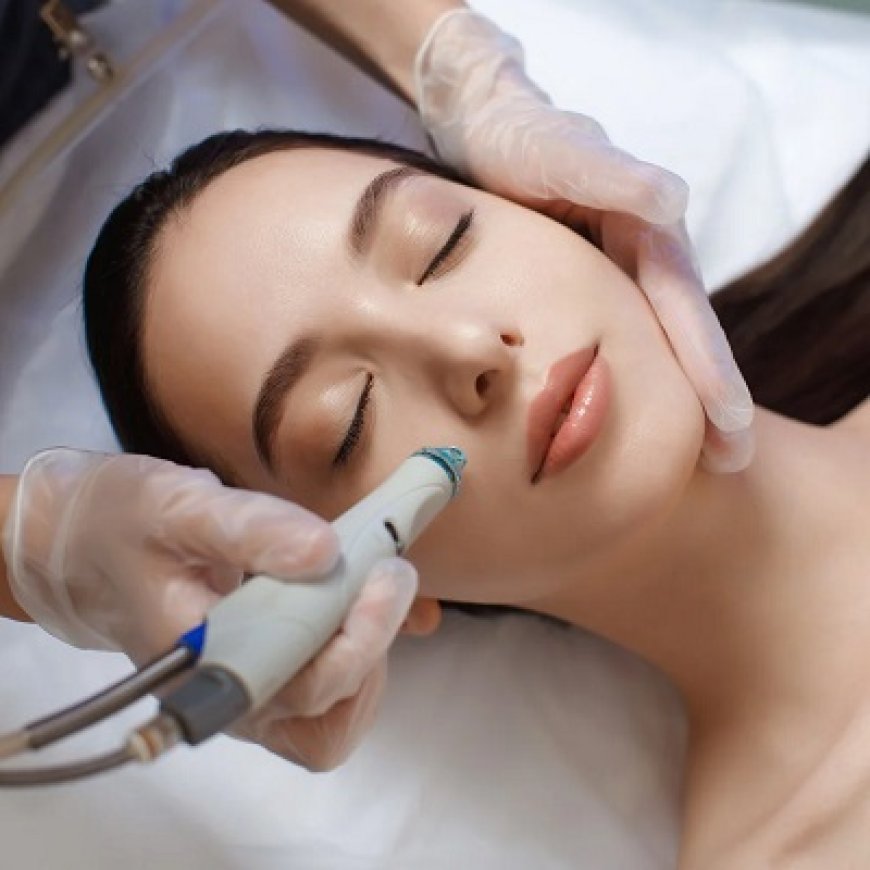 How HydraFacial Complements Laser and Microneedling Treatments