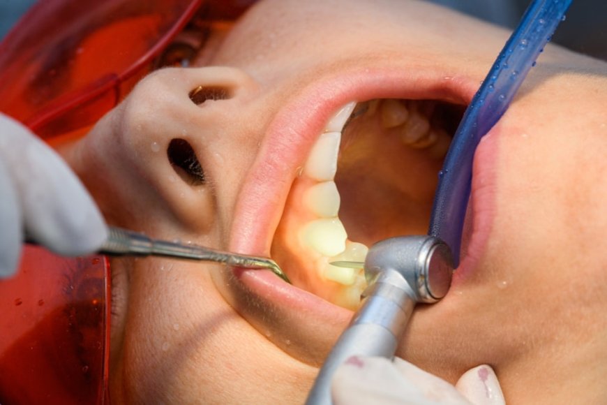 Post-Treatment Care: Protecting Your Tooth After a Root Canal