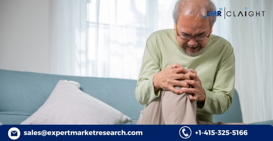 Bone and Joint Health Ingredients Market: Trend Analysis and Future Growth (2034)