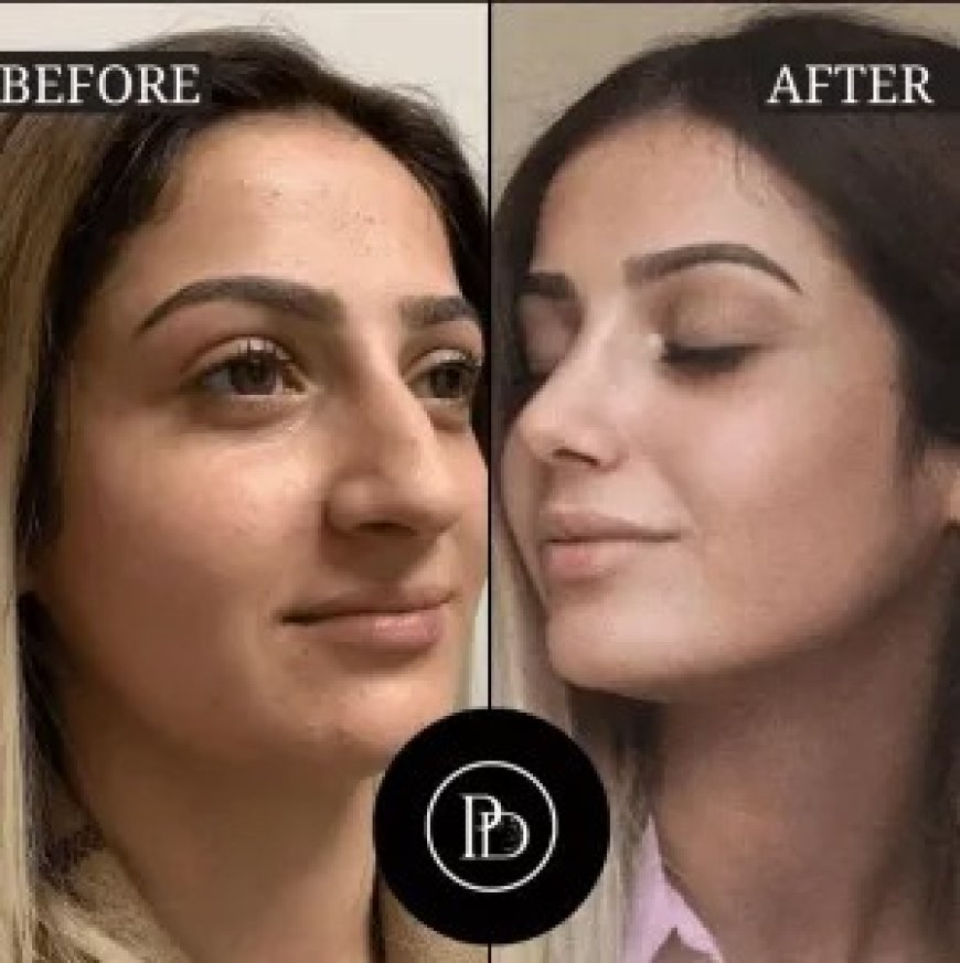 Advanced PRP Treatments in Dubai for Hair Regrowth