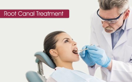 How Much Does a Root Canal Cost Without Insurance?